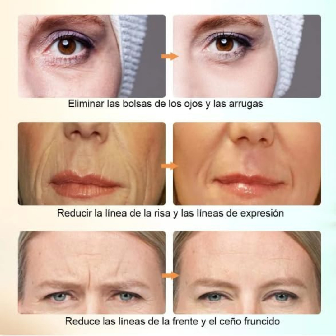 Masajeador Facial  - Rejuvenece tu rostro desde casa con tecnología EMS y despídete de las arrugas